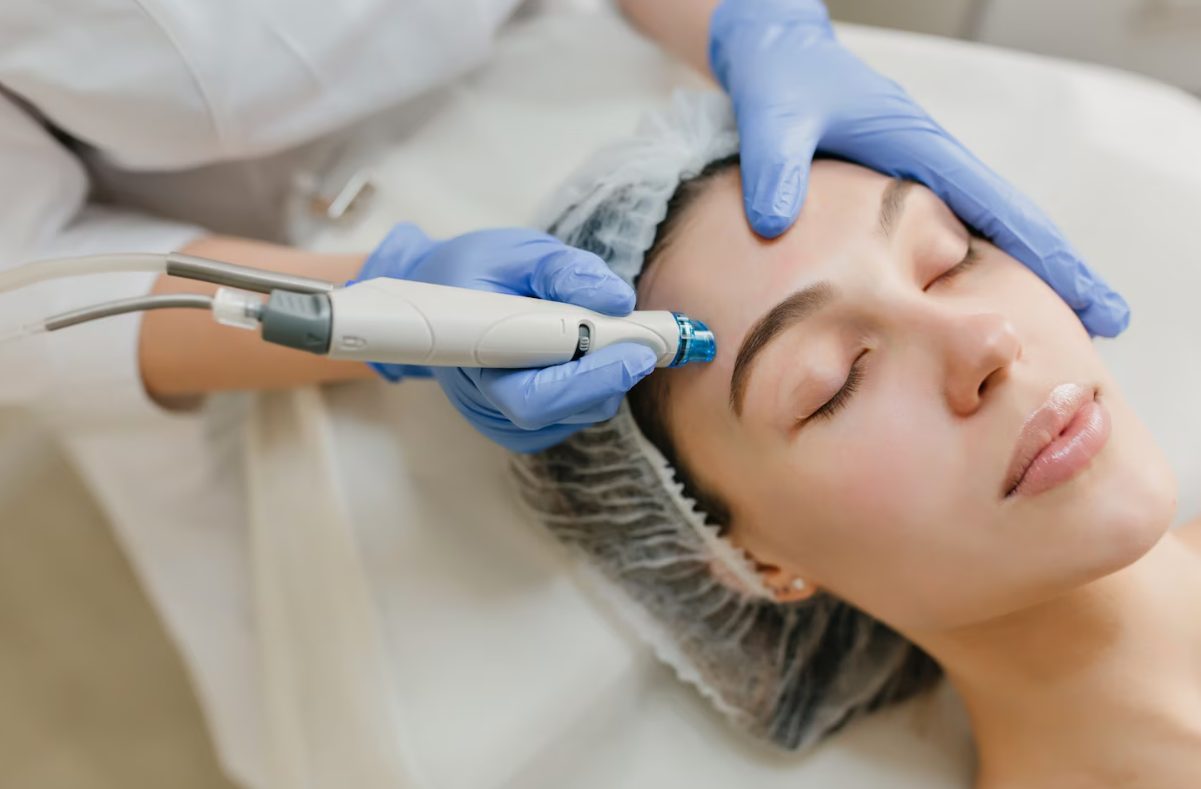 Microneedling bas-kurs